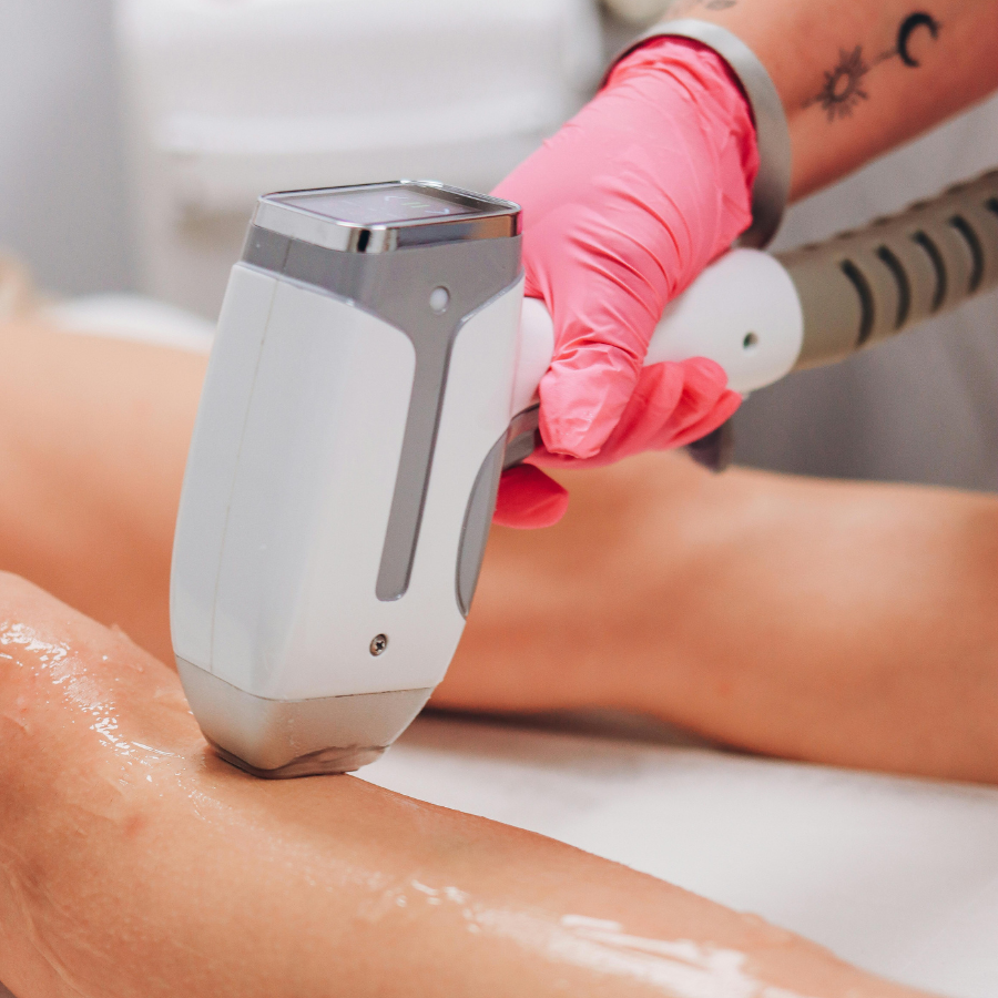 IPL Hair Removal vs. Laser Hair Removal: Which Is Better for You? 🤔✨
